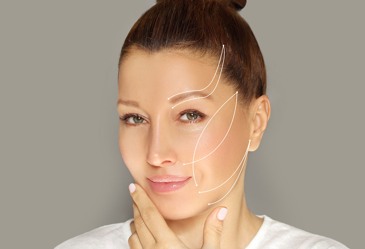 Thread-Lift-treatment